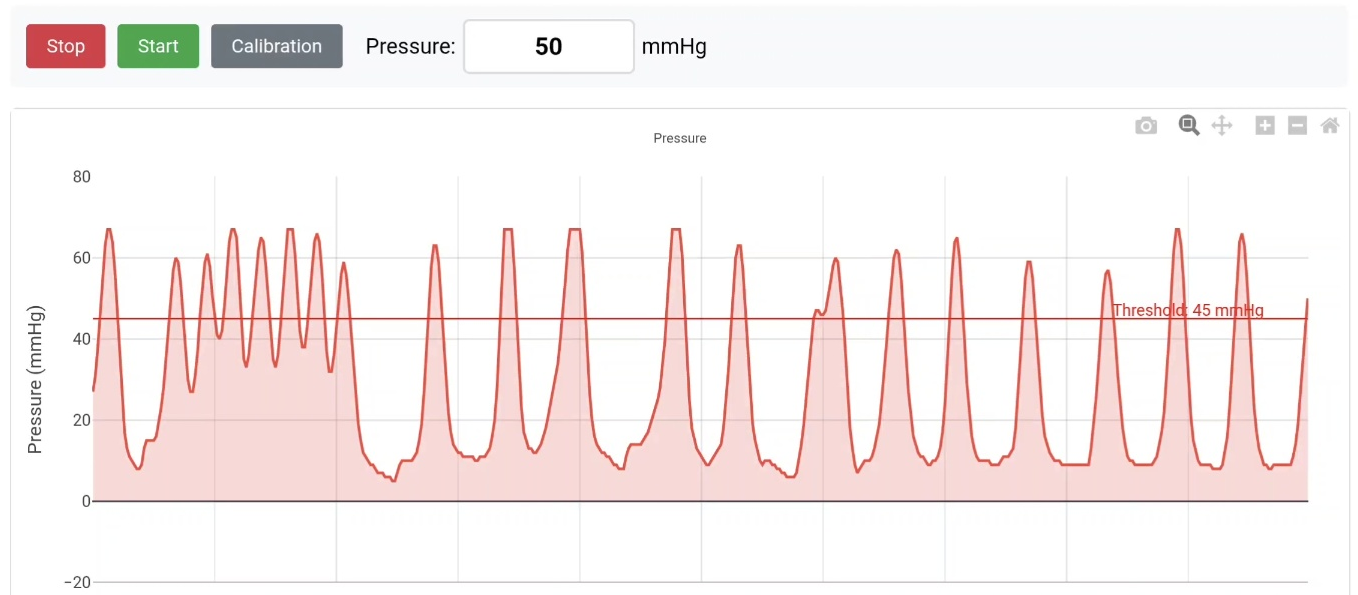 압력 측정 그래프